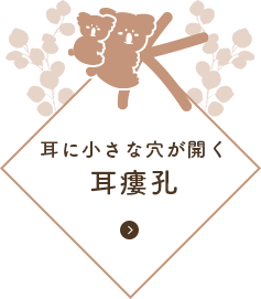 耳に小さな穴が開く 耳瘻孔