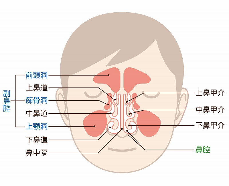 副鼻腔炎（蓄膿症）