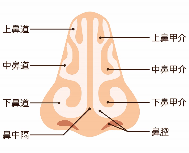 鼻中隔湾曲症