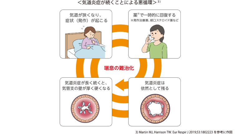 発作を抑える薬